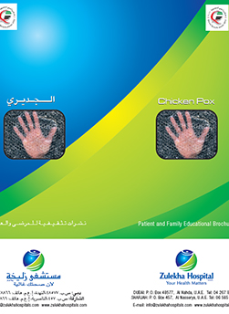 https://zulekhahospitals.com/uploads/leaflets_cover/16What-is-chickenpox.jpg